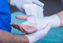 The Importance of Seeing a Hand Doctor in Deltona for Injuries