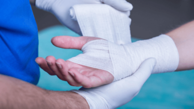 The Importance of Seeing a Hand Doctor in Deltona for Injuries